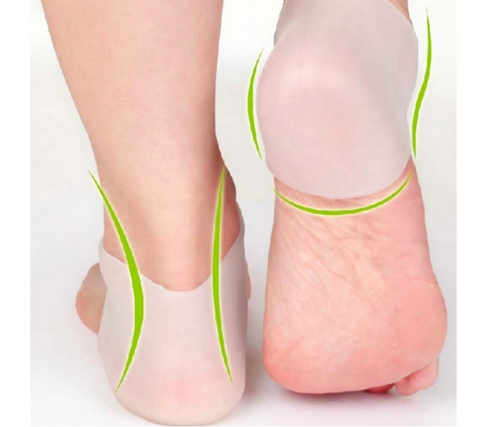 520886 Paire de protège-talons en gel pour prévenir les inflammations