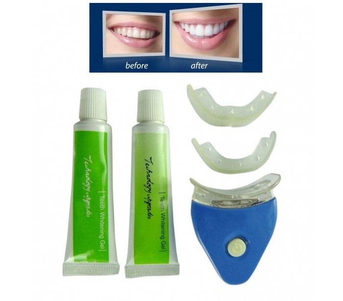 Kit de blanchiment des dents – Résultats dents blanches en 20 minutes