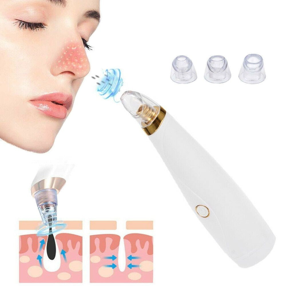 415007 Aspirateur pour enlever les points noirs boutons pour le nettoyage visage